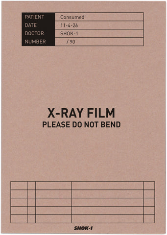 Consumed X-ray Mini print